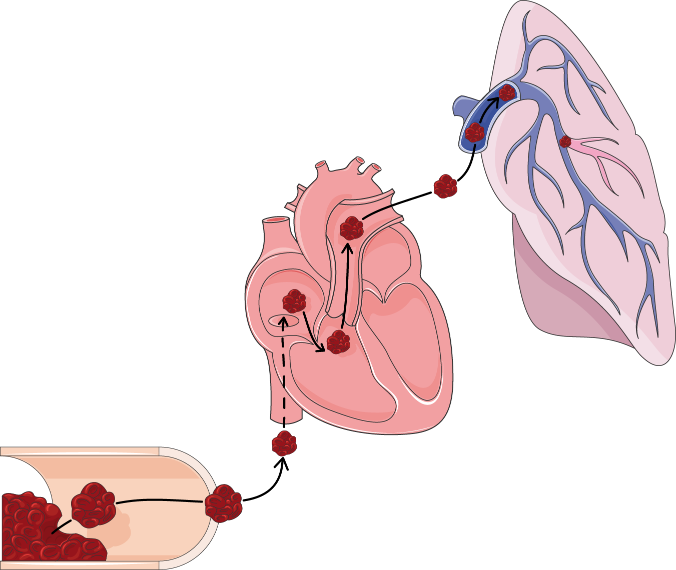 Lung Png Transparent (white, silver, pink)